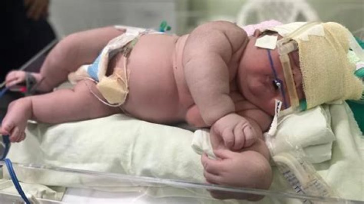 14-Pound Utah Baby Largest Born In US In 2013 – Hollywood Life