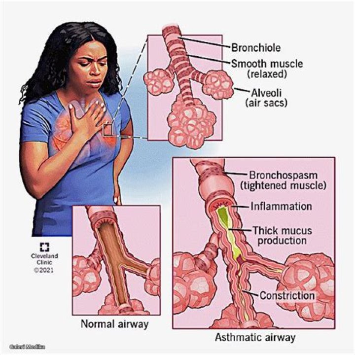 Broadway Star Laurel Griggs, 13, Cause of Death Is Revealed – Hollywood Life